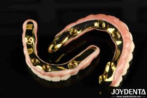 Quality Custom Made Excellent Strength Zirconia Hybrid Bridge Perfect Fit For Your Manufacturing Needs wholesale