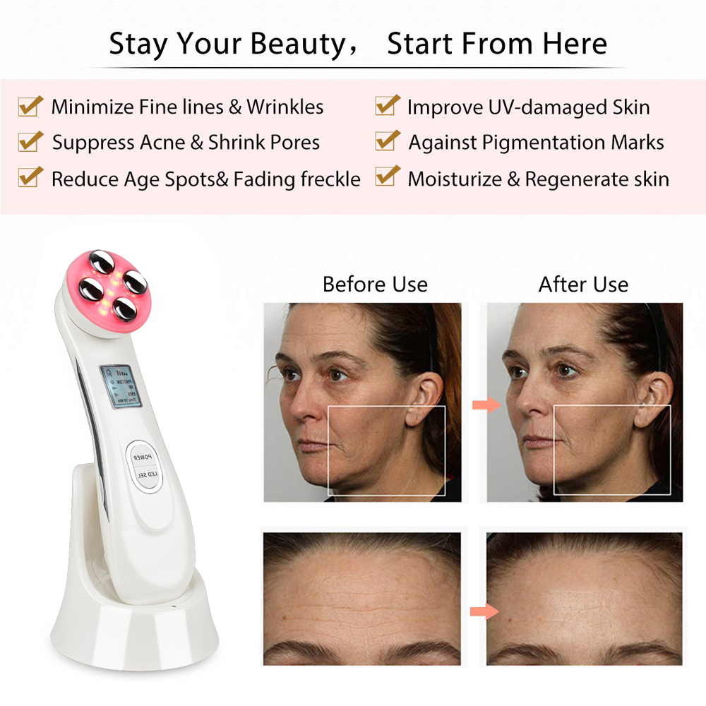 5 in 1 LED EMS Mesotherapy RF Photon Therapy Facial Ultrasonic Vibration Device