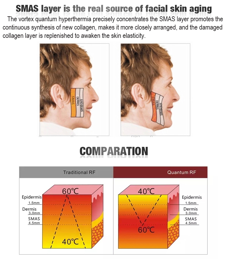 CE Certified Radio Frequency Skin Tightening Machine , Slimming Rf Beauty Instrument