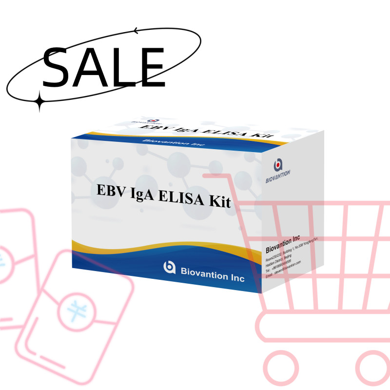Professional Elisa Test Kit For Diagnostic Kit For IgA Antibody To EBV-Zta