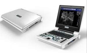 Quality Laptop USG Machine Portable Ultrasound Equipment USS Scanner wholesale