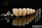 Experience Ultimate Esthetics With Aesthetically Pleasing Dental Implant Crown