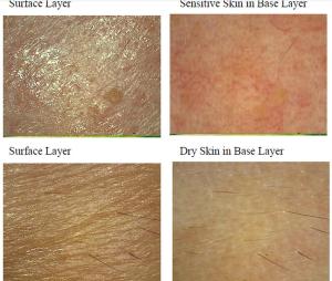 Quality Facial Uv Skin Analyzer Machine For Skin Mositure / Grease / Wrinkle / Pigmentation wholesale
