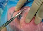 Eye / Ophthalmic Disposable Sterile Surgical Drapes With Incision Film With