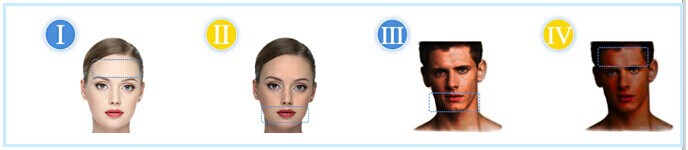 Hair removal 808nm diode laser,high power laser