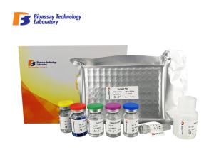Quality Professional Ps Human Elisa Kit Customized Accurate Quantitative Detection wholesale