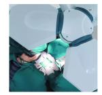 Adjust Colour Temperature High Grade Shadowless Surgical Lamp LED Ceiling Lamp