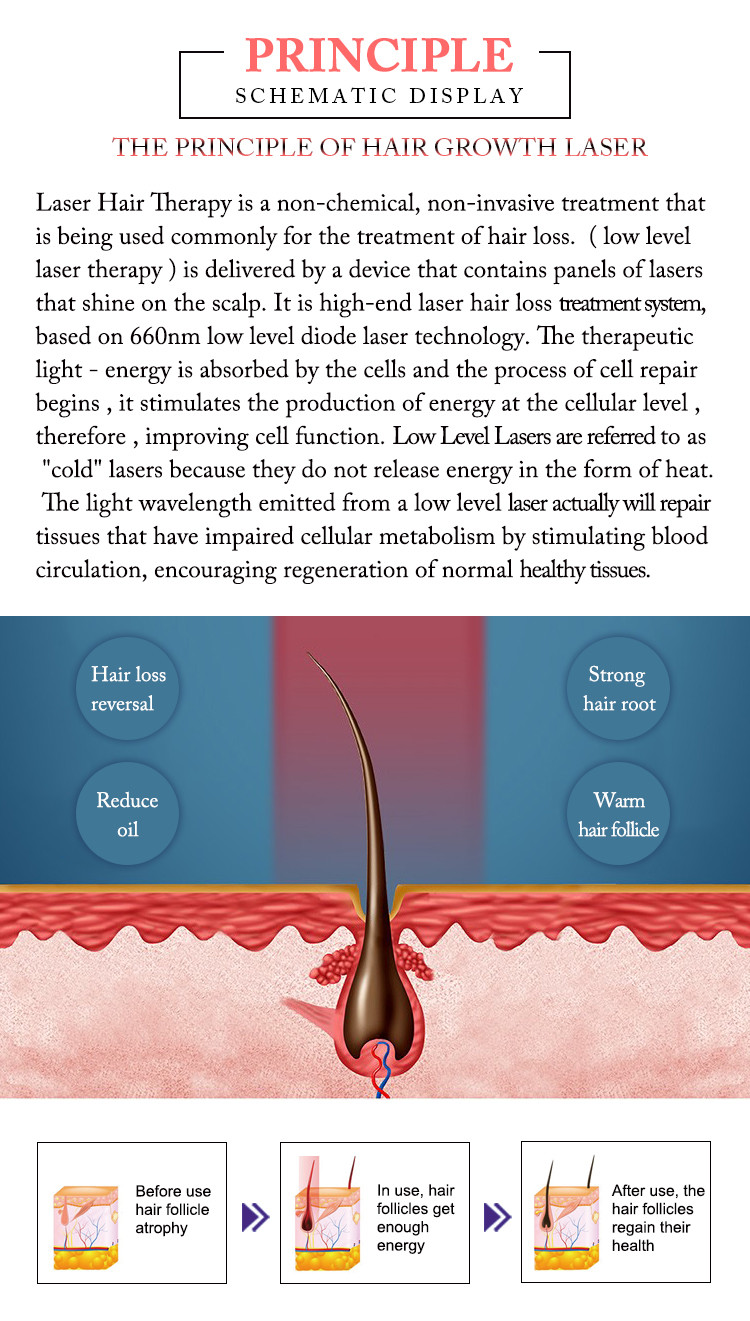 660nm Diode Laser Hair Growth Machine , Anti Hair Loss Treatment Machine