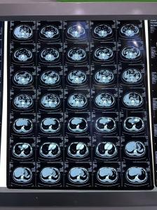 Quality Medical Equipment Blue Density Laser X Ray Thermal Print Film wholesale