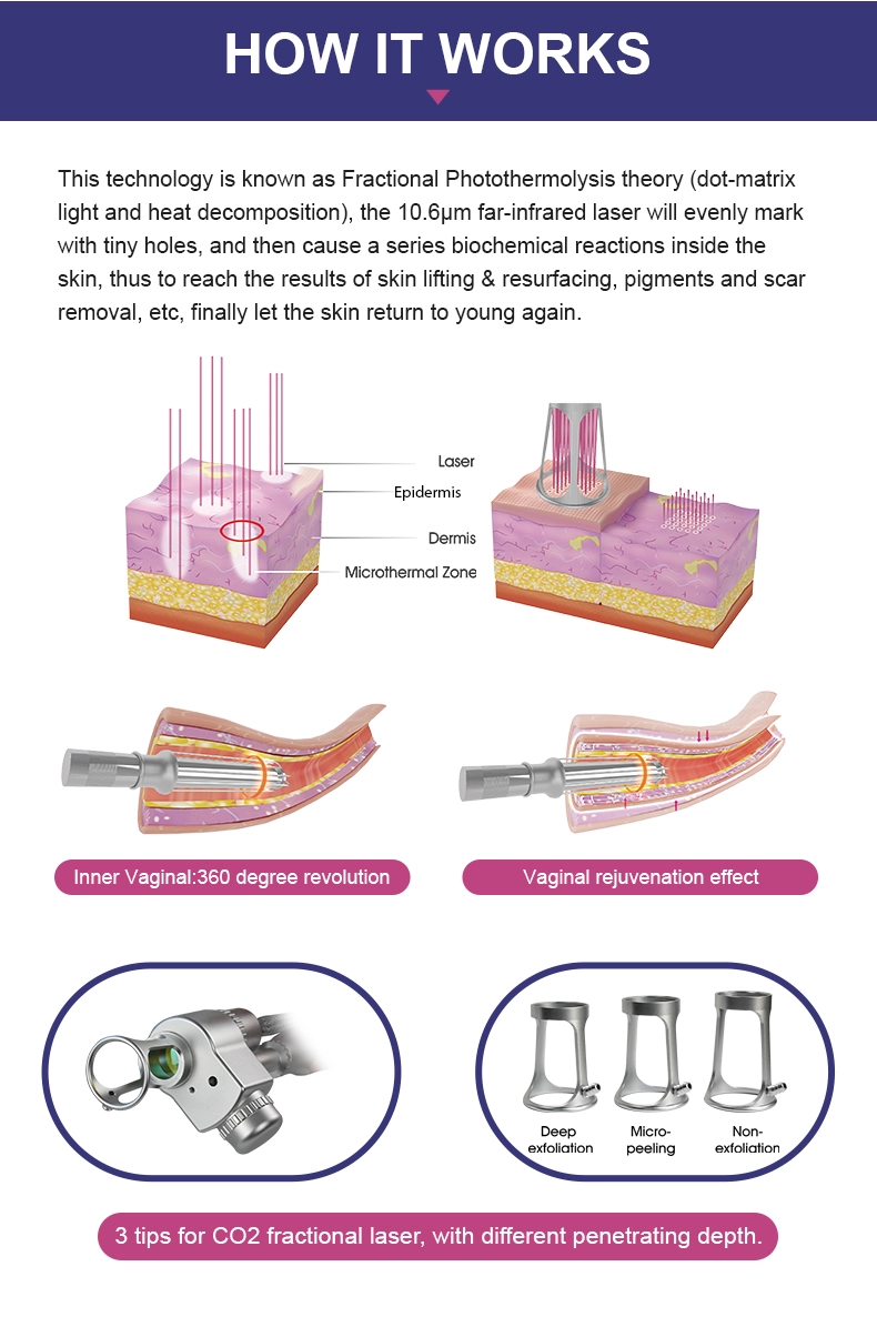 Vaginal Tightening Fractional Co2 Laser Machine 10600nm