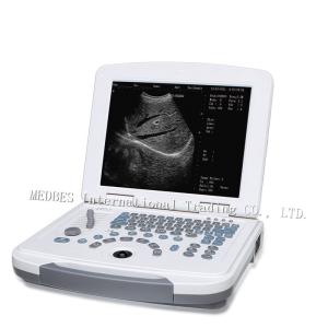 Quality Clinic 80 elements Laptop Ultrasound Machine B580 with Battery wholesale