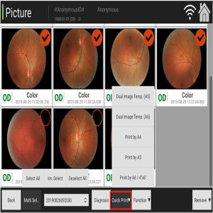 Quality Manual Digital Fundus Camera Ophthalmology Coherence Tomography wholesale