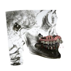 Quality Customized Rubber Fixed Orthodontic Appliances Easy Maintain wholesale