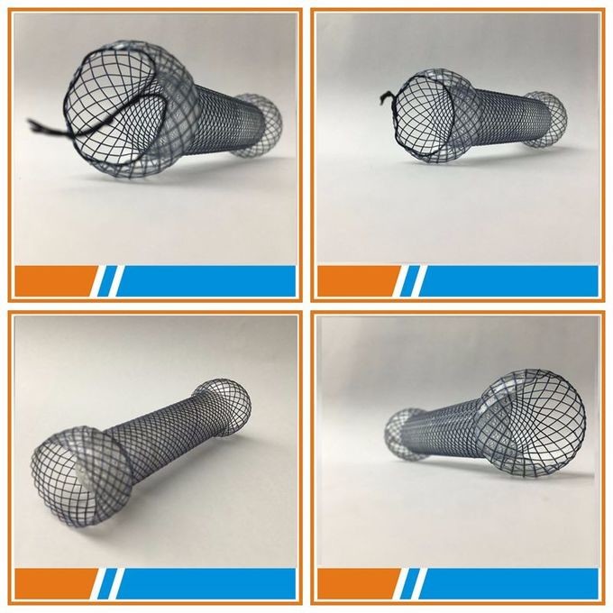 Metallic Metal Covered Segmented Esophagus Stent Gastric Fistula Stent