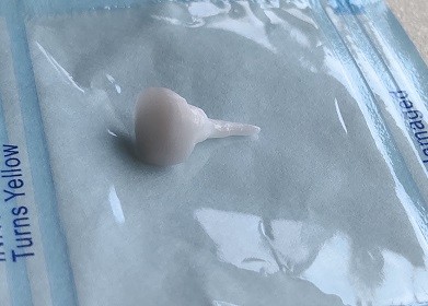 Reinforcing EMAX Porcelain Dental Pin Core