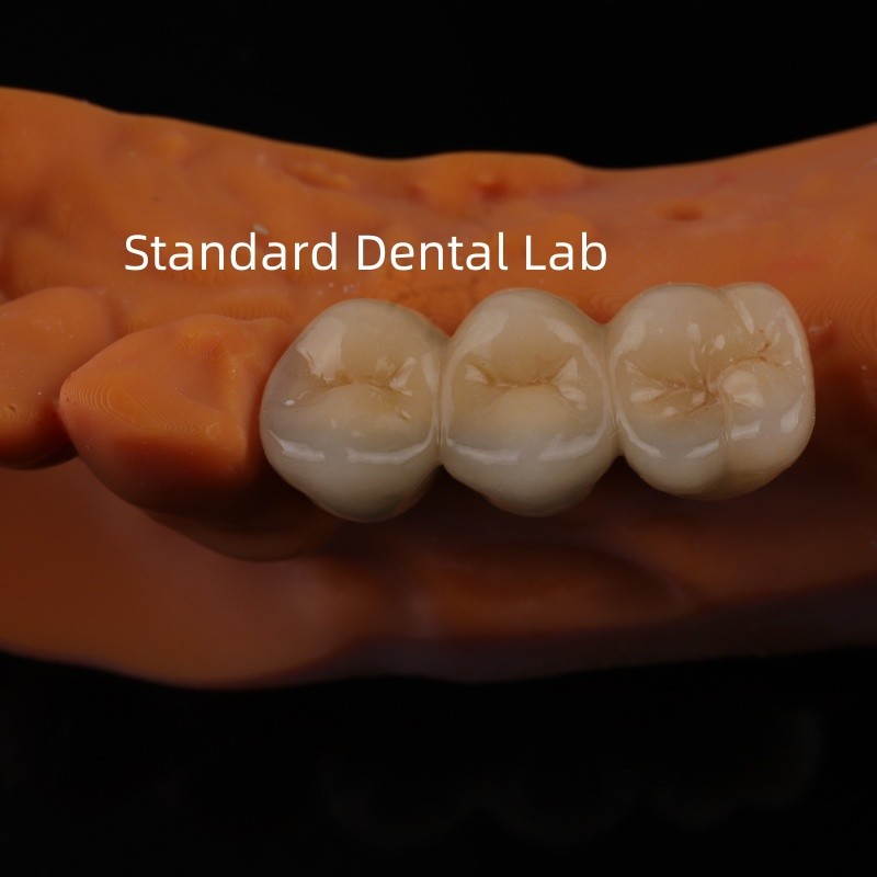 Digital CAD CAM Dental Lab Crowns Translucent Layered Zirconia Crown