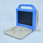 Promotion Medical Equipment Portable Laptop Ultrasound Scanner Machine