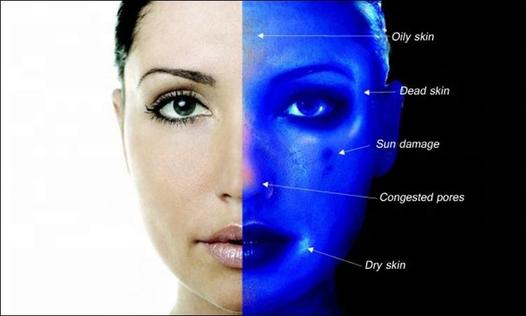 Doctor Clinic 20Megapixel 3D Skin Analyzer Machine Face Camera 7.9kg Nw