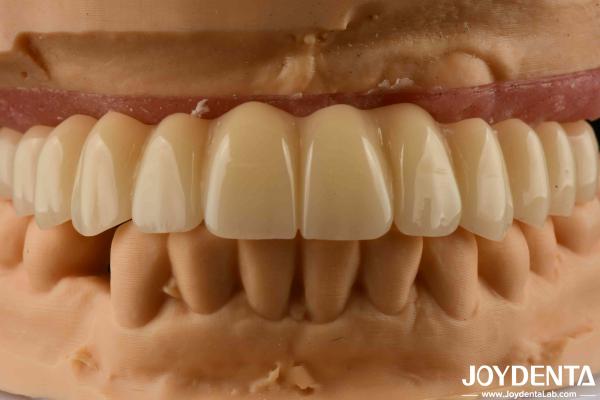 Dental Solution Ti-Base Zirconia Hybrid Bridge High Biocompatibility Natural