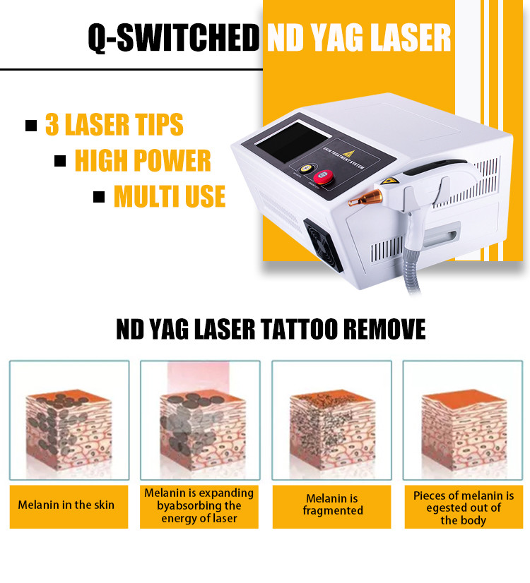 Advanced Q Switched ND Yag Laser Machine for Skin Pigmentation Treatment
