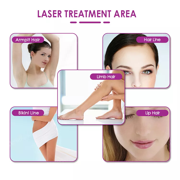 755 808 1064nm diode laser/diodenlaser 808nm handstuck/ Portable 808nm diode laser hair removal machine price for sale