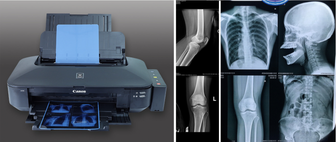 High Speed 8"*10" Blue PET Professional Inkjet Radiography Xray Film For Printer