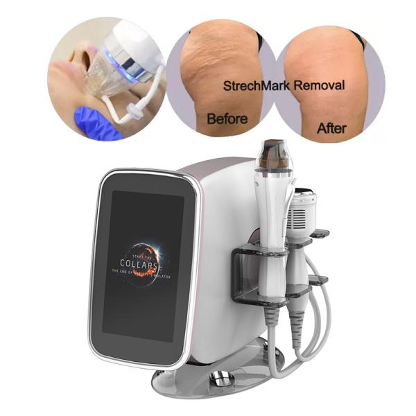 Portable Radiofrecuencia Fraccionada Face Lift Scarlet Fractional Rf Radio