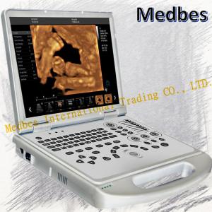 Quality Portable Ultrasound Machine Doppler Ultrasonic Diagnostic E2 Sonoscape Price wholesale
