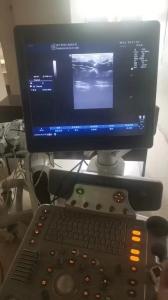 Quality GE original imaging ultrasound machine Logiq P6 wholesale