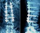 Quality High Sharpness Medical X Ray Films wholesale