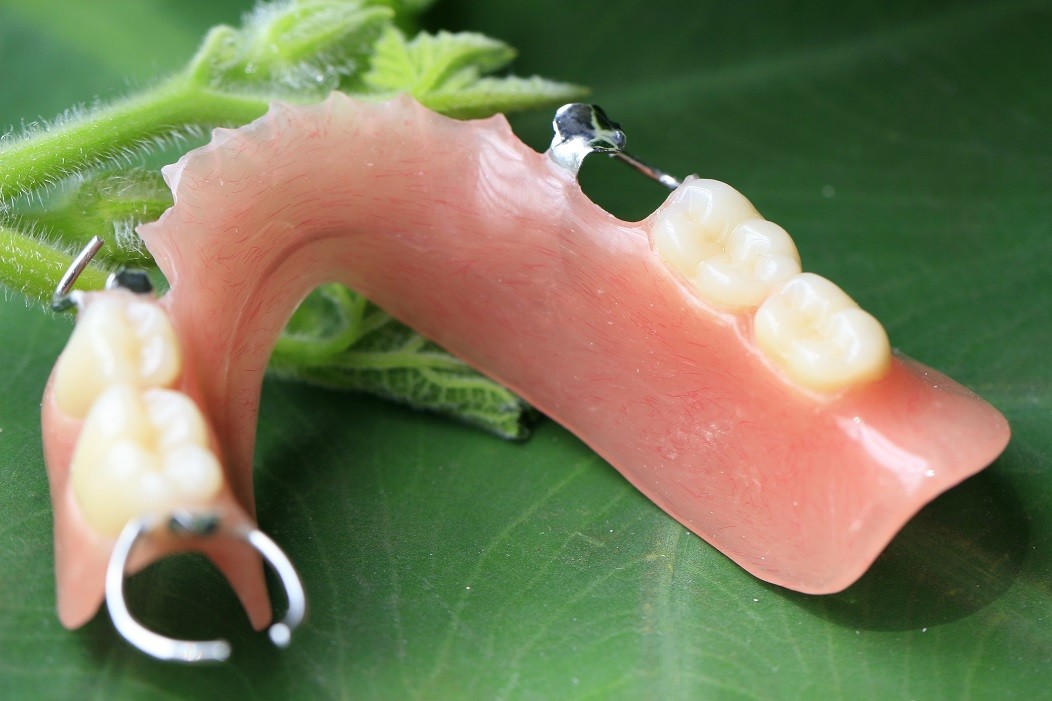 Partial Removable Acrylic Partial Denture