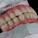 Porcelain Zirconia Dental Implant Bridge Professional High Esthetics With Pink