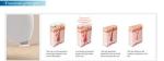 3 years warranty 10.4 inch touch color screen permanent laser diodo 808 nm hair