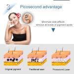 110v 220v Permanent Hair Removal Laser Machine Diode Depilation