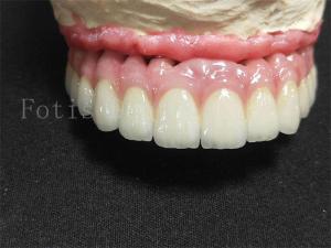 Quality Titanium / Zirconia Implant Crown Polished Finish Artificial Dental Crown wholesale