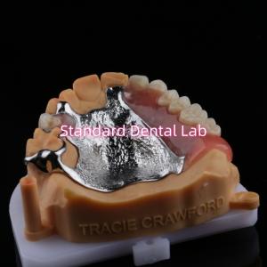 Quality Upper Cast Framework Acrylic Metal Partial Dentures Strong Lightweight and Durable wholesale