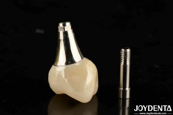 Biocompatible Dental Implant Crown And Bridge Aesthetically Pleasing For Safe