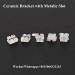 Class II Instrument Classification Dentistry Affordable Clear Bracket Ceramic