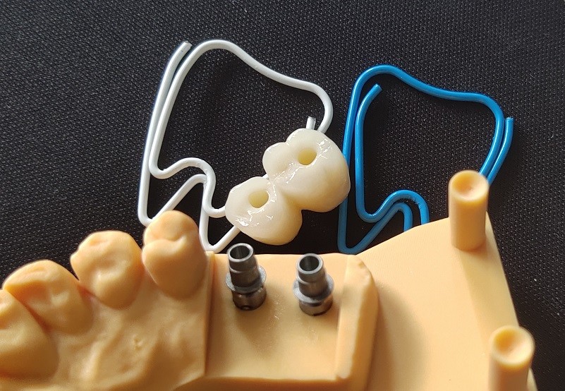 Natural ASC Angled Screw Channel Dental Implants Crown