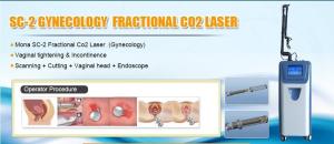 Quality Professional rf co2 fractional laser with CE certification wholesale