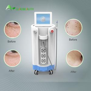 Quality For Blood Spider clearance Diode Laser Spider Vein Removal Machine 980nm wholesale