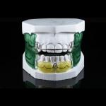 Customized Orthodontic Frankel Dental Device for Misaligned teeth