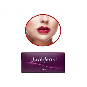 Quality Juvederm Ultra 3 Hyaluronic Acid Dermal Filler Russian Lips With Lidocaine wholesale