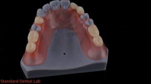 Quality 3D Print Model High Esthetics Dental TCS Valplast Flexible Partial Dentures Dental Lab wholesale