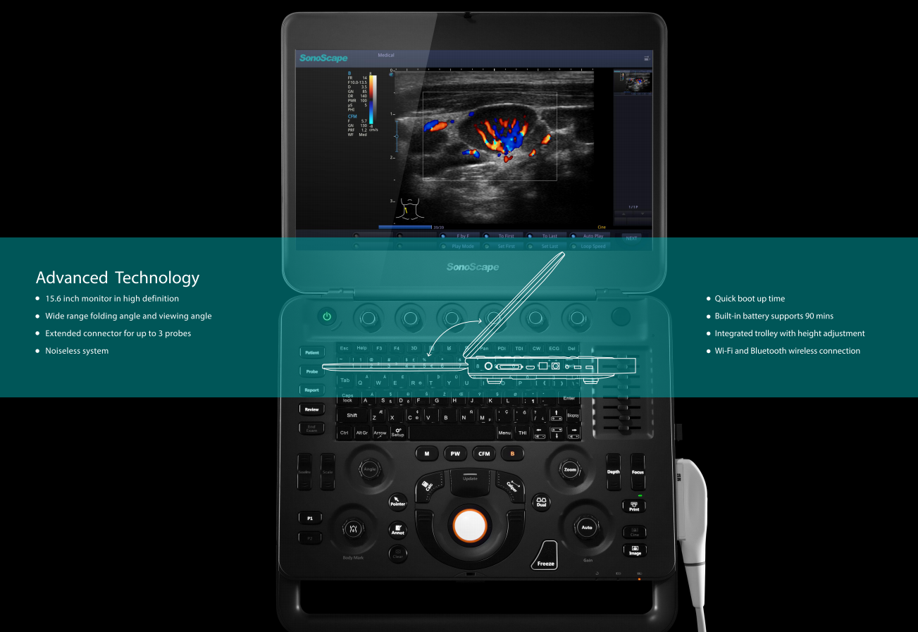 Sonoscape X5 Medical Ultrasound Instruments Machine with Excellent Image Quality