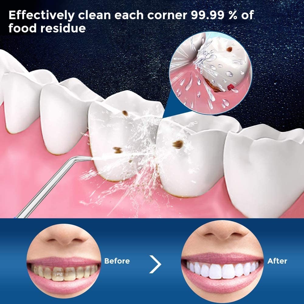 5 Modes Electric Cordless Water Flosser With 300ml Water Tank