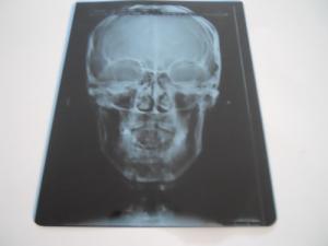 Quality Professional Dry Imaging Film With Image Layer 14x17inch wholesale