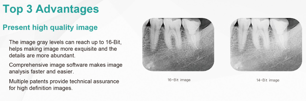 CR Imaging Plate Intraoral Dental X Ray Film Scanner