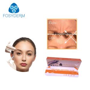 Quality Syringe Packaging Hyaluronic Acid Facial Filler Smooth Texture MOQ 1Box wholesale