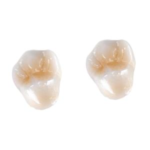 Quality All-Ceramic FDA 3014652903 Zirconia Dental Crown Veneer Inlay Onlay wholesale
